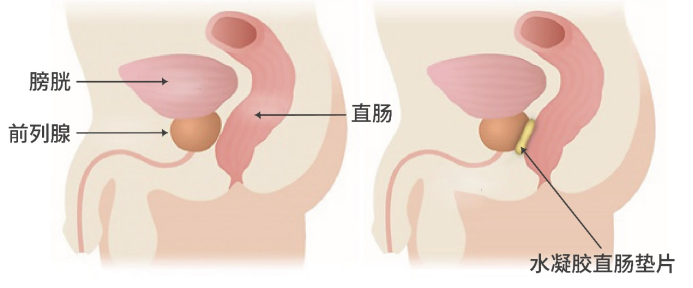 640 (6).png